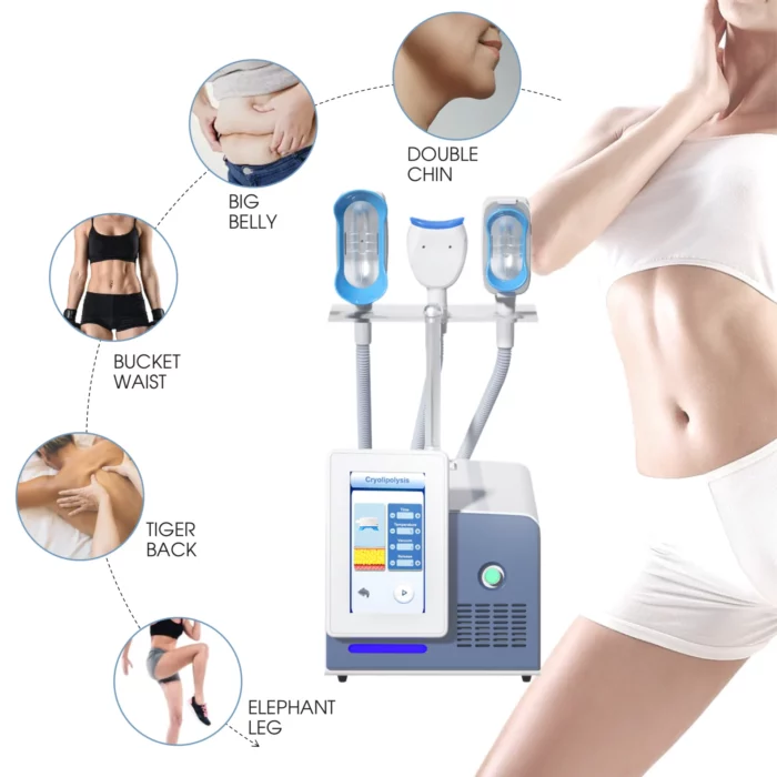 Tingmay 360 Fat Freeze Machine for Body Slimming - Image 3