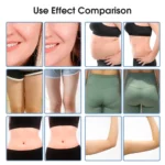 Tingmay 360 Fat Freeze Machine for Body Slimming - Image 7