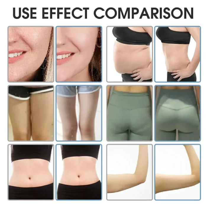 Tingmay Vertical 360 Cryolipolysis Machine For Fat Freezing - Image 7