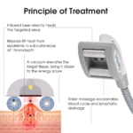 Tingmay Cold and Thermal Cryoskin Machine For Cellulite Removal - Image 4