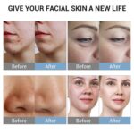 Tingmay 6 in 1 Oxygen Hydrodermabrasion Facial Beauty Machine - Image 7