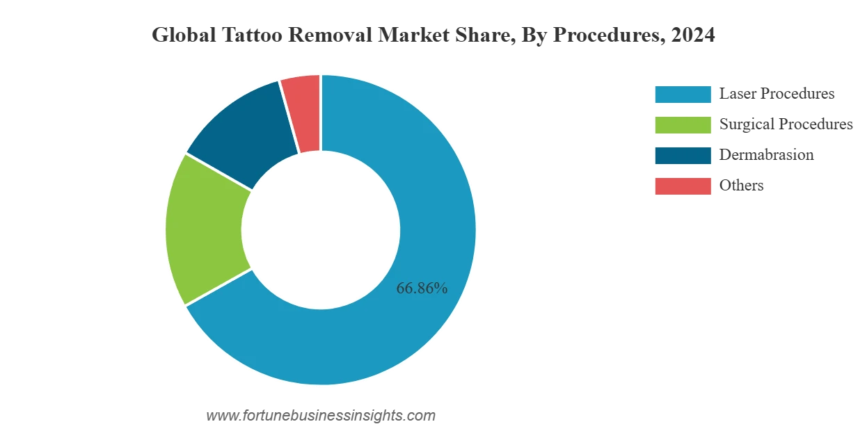 tattoo removal market
