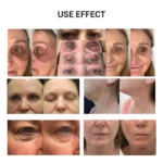 www.hktmay.com_plasma_TM-L03 Tingmay Fusion Plasma Skin Care Device_Before and After