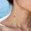 _www.hktmay.com_blog_Boosting Your Spa's Revenue: A Complete Guide to Professional Skin Tag Removal Machines