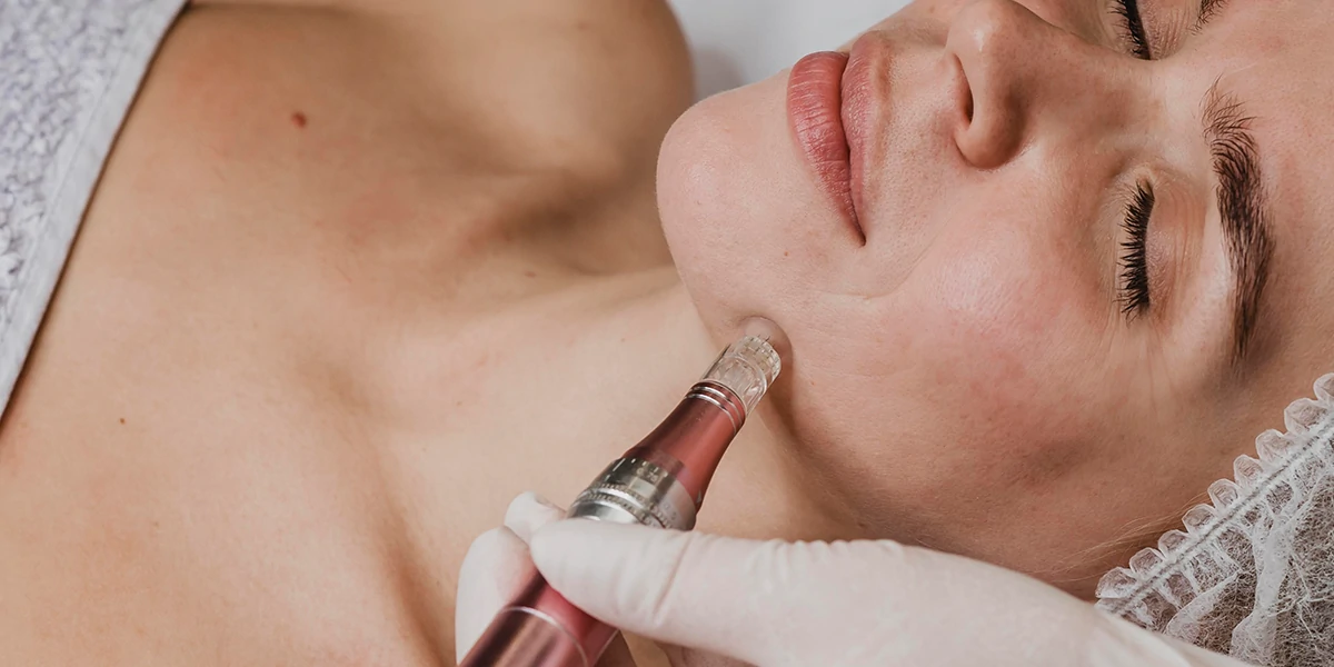 www.hktmay.com_blog_Microneedling RF Gone Wrong: Risks, Causes, and How to Ensure a Safe Treatment_01